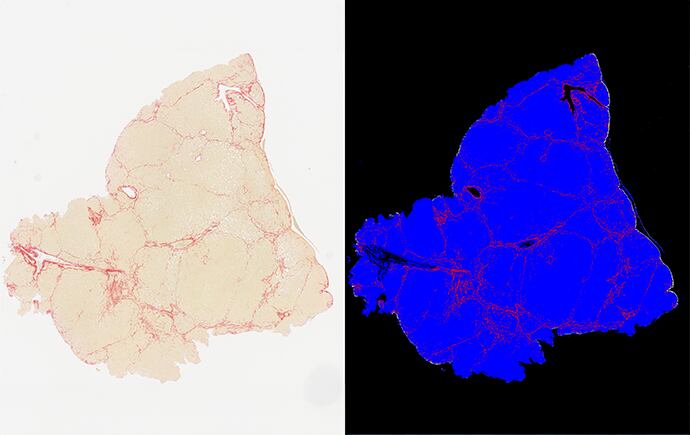 A CaMKK2 regula o uso de energia nas células e em todo o corpo