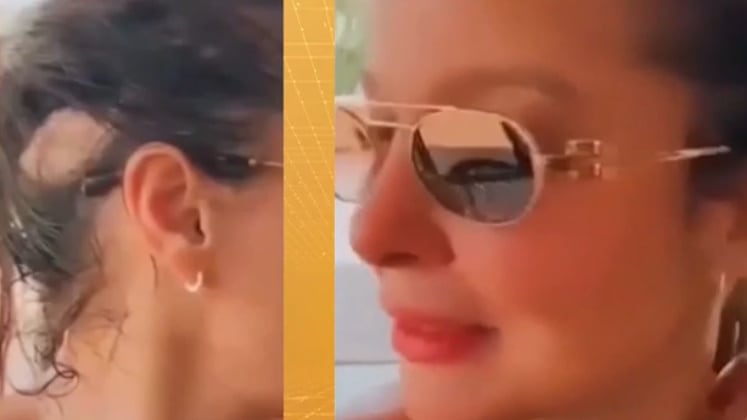 Maiara, da dupla com Maraisa, sofre com alopecia