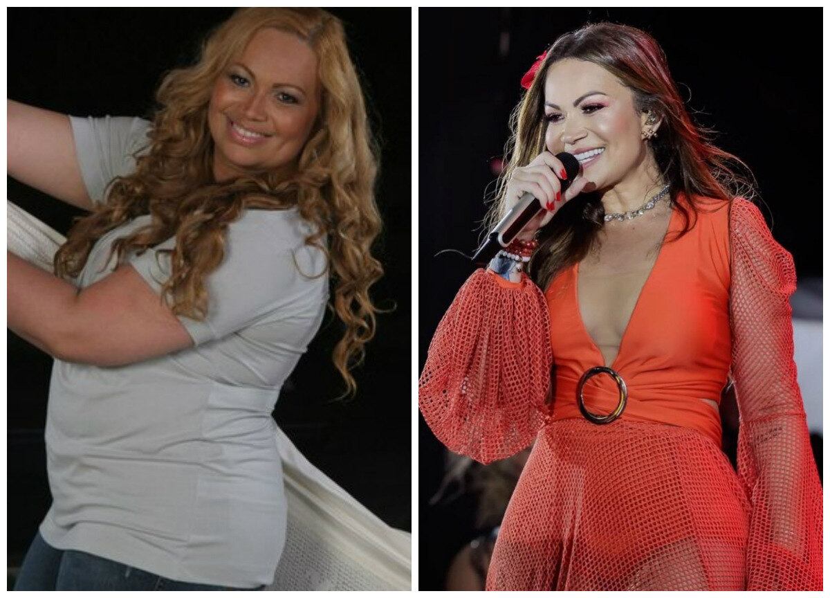 Solange Gomes conta como bariátrica mudou a sua vida