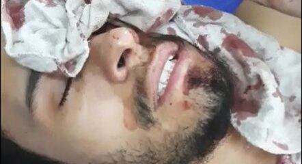 Motorista vai passar por cirurgia nesta quarta (18)