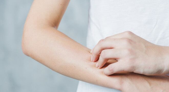 Até o momento, 2014 era o pior ano em casos de sarampo nos EUA