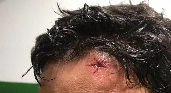Jogador sofreu ferimento na cabeça após invasão de vestiário no Carioca