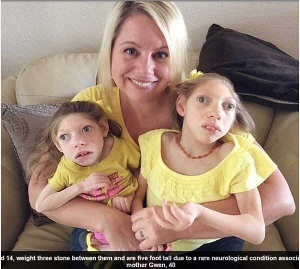 Duas irmãs, de nove e 14 anos, nasceram com microcefalia, má-formação cerebral que prejudica o desenvolvimento neurológico. Infelizmente, elas não falam, não escutam, não conseguem se vestir sozinhas 