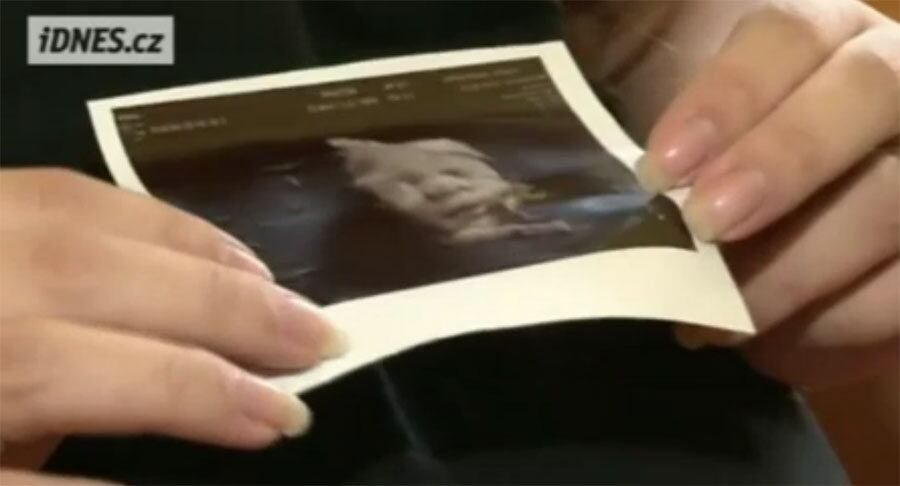 

 “Quando
eu finalmente vi a quinta cabeça, comecei a chorar”, afirmou Alexandra a um
canal de TV local

