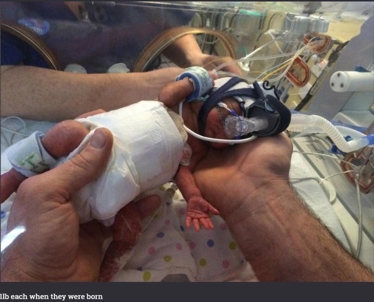 Sapphire e Ruby pesavam aproximadamente 453g quando
foram entregues para a emergência. Para mantê-las aquecidas depois de nascerem,
elas foram cobertas em uma espécie de plástico bolha