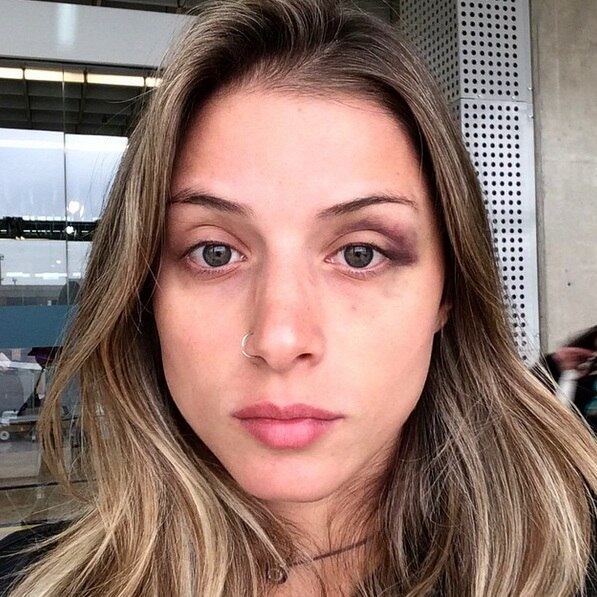 A
dançarina Ângela Sousa foi agredida ano passado pelo então namorado, o ex-BBB
Yuri. Eles estavam em um viagem quando ele espancou a namorada. Na época, ele
foi enquadrado na Lei Maria da Penha, mas pagou fiança de R$ 5 mil e deixou a
prisão