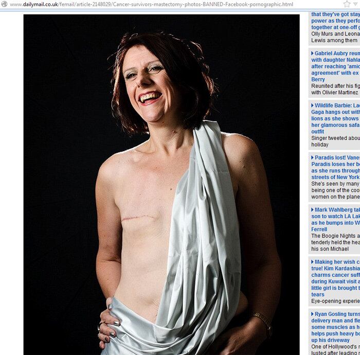 Joanne Jackson superou um cancer de mama, mas teve que remover o
seio. Ela decidiu colocar a foto da superação na rede social, que acabou
banindo. Afinal, julgou que havia nudez. Joanne ficou revoltada na
época