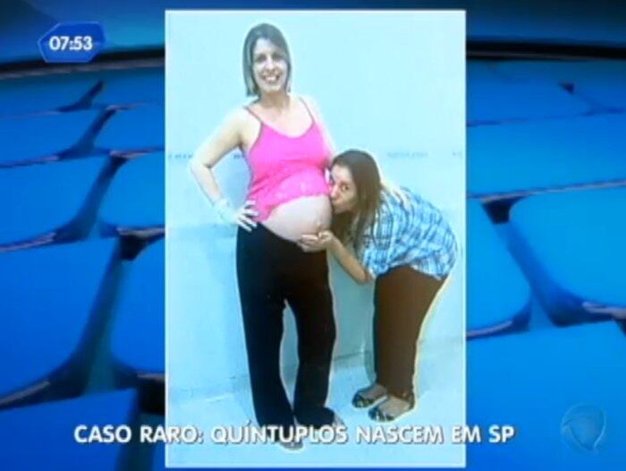 Na hora do parto, foram cinco equipes médicas
trabalhando ao mesmo tempo. Ao todo 26 profissionais dentro do centro cirúrgico.  Em apenas três minutos. foram tirados todos os
bebês


Desempregado, pai de quíntuplos ainda não sabe como vai fazer para sustentar os filhos





