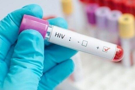 O novo anticorpo poderia tratar todas os tipos do HIV