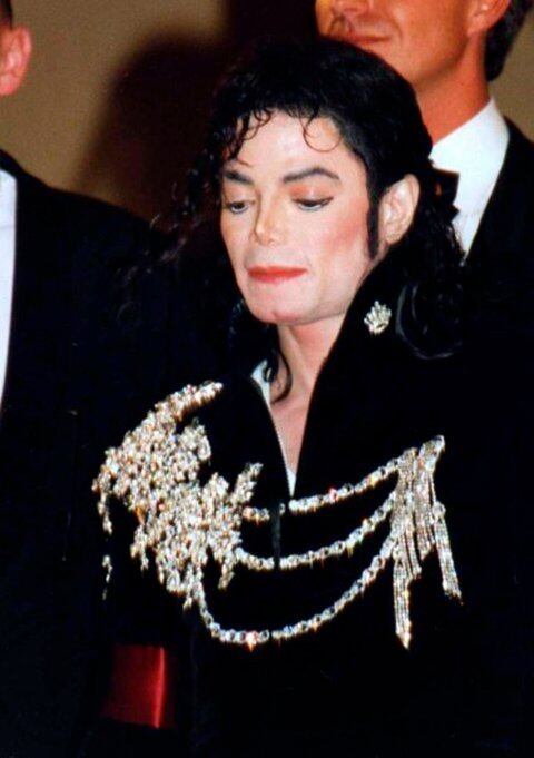 Michael sofria de vitiligo e ia com frequência ao dermatologista. O médico contou que a decisão de