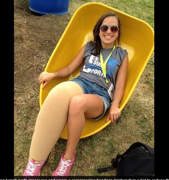 A jovem Isa-Bella
Leclair, de 19 anos, sofre com doença rara que fez com que a perna direita
inchasse. Hoje, o membro é duas vezes maior que o esquerdo, e o coração da
menina precisa trabalhar mais, para bombear sangue para a perna, já que ela é
mais vascularizada que a esquerda. De acordo com o site DailyMail, apesar do preconceito, a garota venceu um concurso de beleza em sua cidade, o que para ela, mostra que é possível quebrar paradigmas e mudar a opinião das pessoas