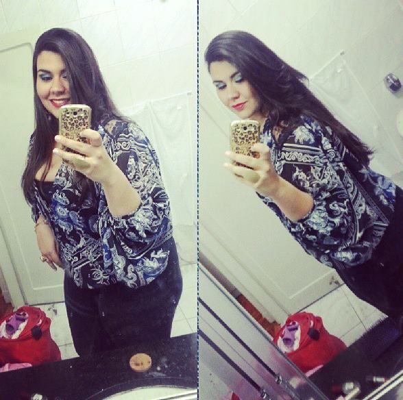 Pós-cirurgia

Hoje, mais magra, ela relembra
seu sofrimento de quando estava obesa.

— Sentia muita dor no joelho. Eu
trabalho a dois quarteirões de casa e me lembro que ficava cansada em ir
andando. Era muito complicado viver