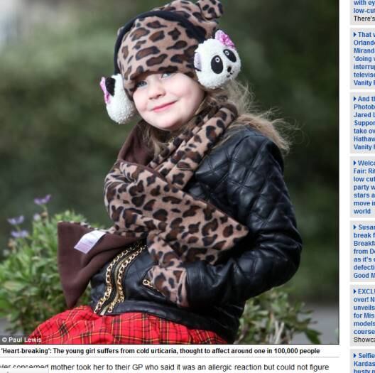 

Sua mãe, Nicola Davies, afirma que já gastou milhares de
dólares com roupas de esqui e aquecimento em casa para proteger a filha.


— É de partir o coração, ela não pode nem sair para brincar com as
amiguinhas. Tento explicar para ela o porquê
disso, mas não é fácil falar isso para uma criança



Protetor solar que quase deixou britânica cega causa alergia grave em outra mulher