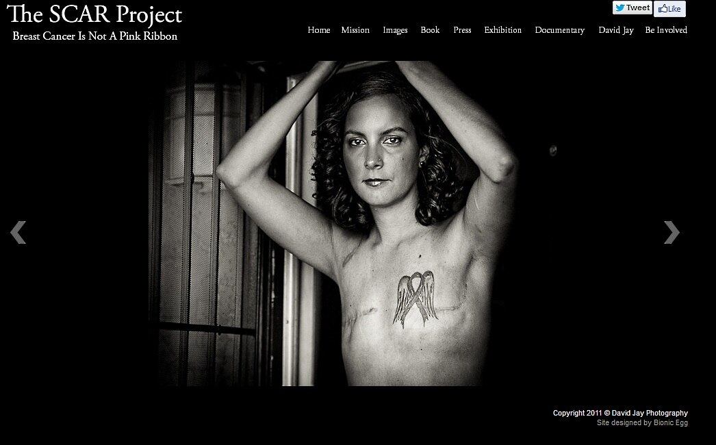 Outra campanha na internet que ganhou destaque foi a de mulheres sobreviventes do
câncer de mama. Intitulada The Project Scar
(Cicatriz, em inglês), a iniciativa do fotógrafo americano David Jay revela que
autoestima, feminilidade e sexualidade podem ser preservadas após o diagnóstico da doença.
Leia mais


Cirurgia de Angelina Jolie reduz em 95% de chance de aparecimento do câncer de mama hereditário
