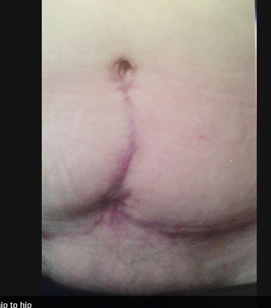 

— Conheci diversas clínicas, boas e más. A operação nessa
clínica me custou cerca de 3.000 libras [R$ 12 mil], incluindo voos, cirurgia e
alojamento. Fiz um empréstimo para pagar tudo isso.

Não recomendo para ninguém