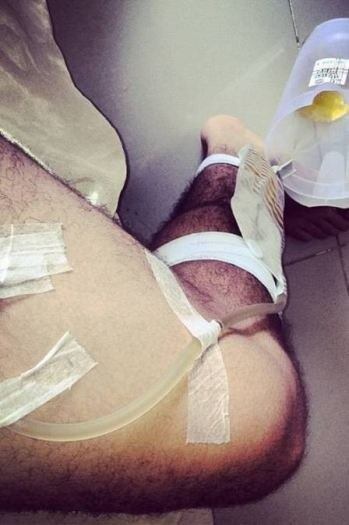 No natal passado, Elbe revelou que estava com uma sonda na sua perna, forma que tornou possível urinar durante a recuperação da cirurgia