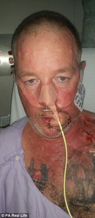 Antes de entrar pela segunda vez em uma mesa de operação, ele foi tomado de desespero.
— Meu aspecto era tão ruim que temi que pudesse me matar