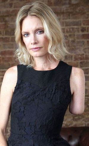 Olivia Jackson após o acidente