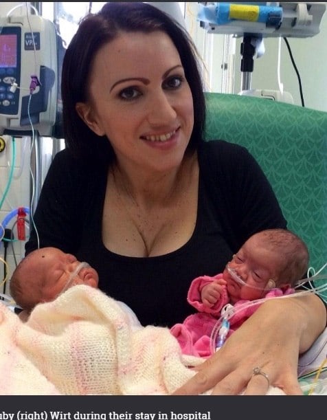 Mãe posta foto de gêmeas que nasceram prematuras com 24 semanas para inspirar outras pessoas. Hoje, aos dois anos de idade, as meninas Sapphire e Ruby Wirt estão esbanjando saúde. Quando nasceram com 24 semanas de vida, as gêmeas eram menores que a mão da mãe Caroline. Na época, os médicos disseram que era incrivelmente improvável que as duas meninas sobrevivessem