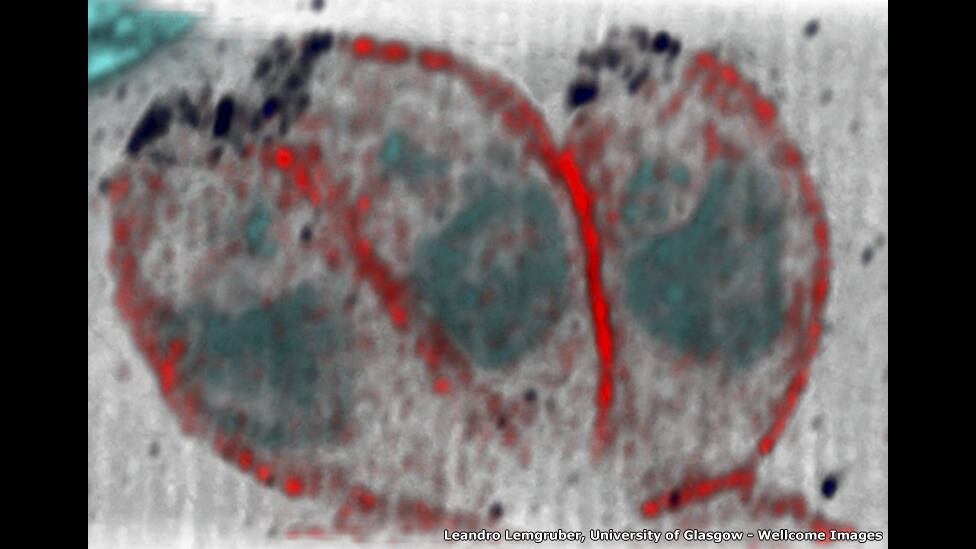 Na imagem de Leandro Lemgruber, são retratados os parasitas causadores da toxoplasmose. O juiz Robin Lovell-Badge disse que a imagem parece desfocada por causa do aumento que sofreu, uma vez que o parasita é minúsculo 