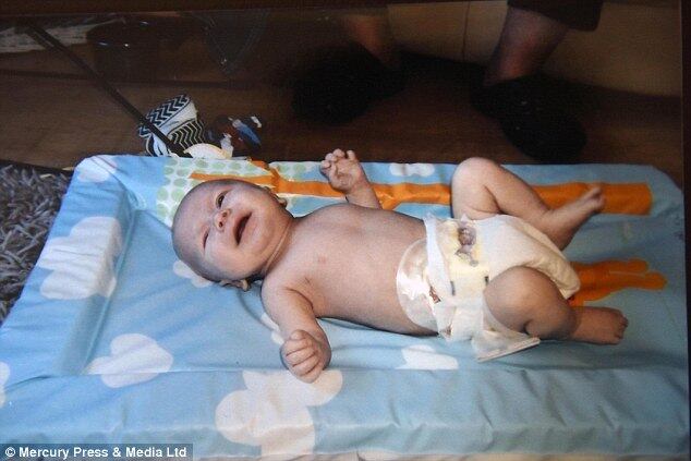 — Me sinto frustrada porque, se isso tivesse sido registrado quando Harry era um bebê, ele não teria que sentir a dor que ele sente agora

