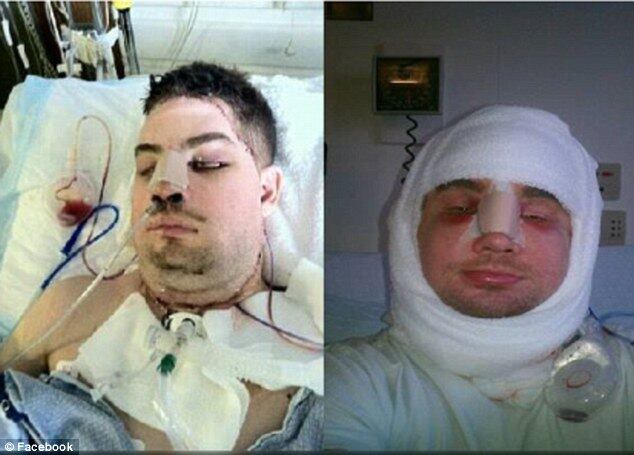 Ele empurrou a mulher que dirigia o veículo para longe da área de impacto — mas acabou recebendo uma força quase letal de energia elétrica