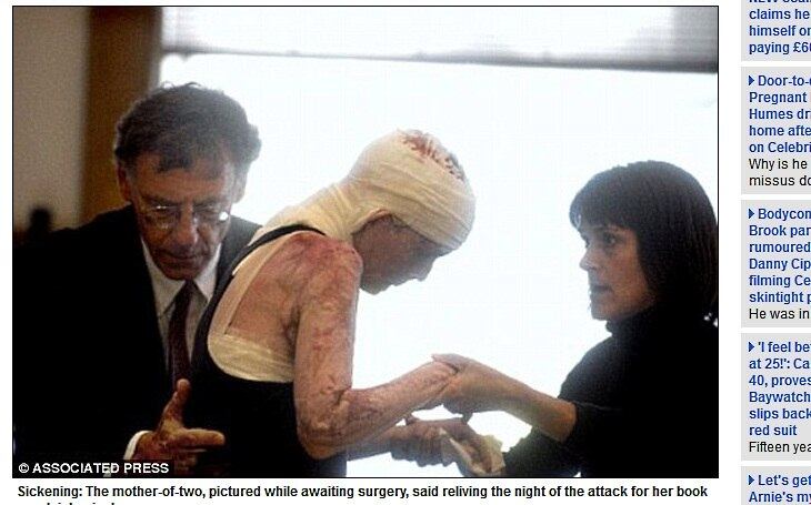 Além disso, os médicos irão avaliar a função motora em volta de seus
olhos para determinar que tipo de procedimento deverá ser realizado para recuperar
o movimento das pálpebras. Infelizmente, ela não pode enxergar