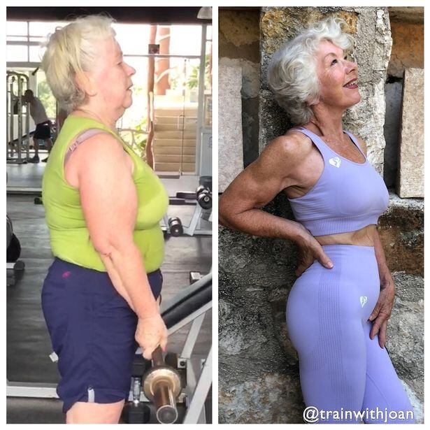 O antes e o depois de Joan MacDonald