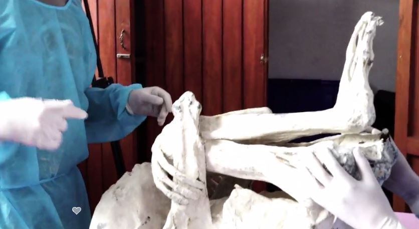 No entanto, esse tipo de prática de alongar o crânio é comum na
sociedades antigas do país. A descoberta foi anunciada no site Gaia.com,
que diz ir contra o senso comum. Também foram publicados vários vídeos
afirmando que essa múmia poderia ser de um ser alienígena