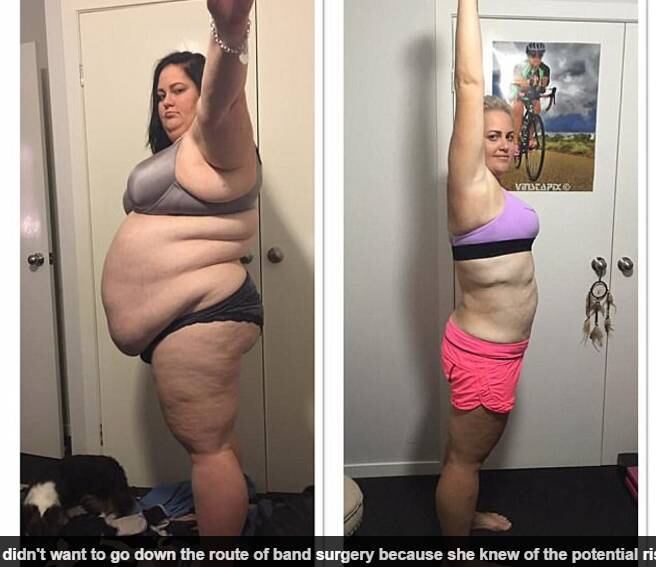 — Em 2015 eu fiz um check-up e meu médico perguntou se eu sabia o quanto eu pesava, mas eu não queria saber. Eu sabia que estava obesa, mas não me pesava. O ponteiro da balança sempre marcava erro porque eu era muito pesada e só podia ser pesada em balanças industriais