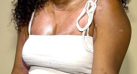 A vítima precisou ficar 10 dias internada