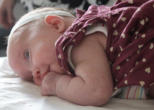 Os cirurgiões tiveram que cortar através Sra Lavis 'abdómen, útero e no saco amniótico para chegar Frankie que a mantinha medula espinhal. A operação levou duas horas e uma equipe de 22 funcionários cirúrgicos envolvidos
Vídeo: Grande parte da população sofre com problema de coluna
Abusar do silicone pode provocar dores na coluna, pescoço e até estrias
“Dor nas costas pode indicar a presença de várias doenças”, alerta médico