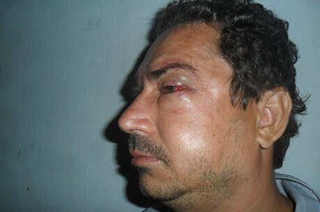 Radialista foi agredido dentro de casa pelo advogado e dois comparsas