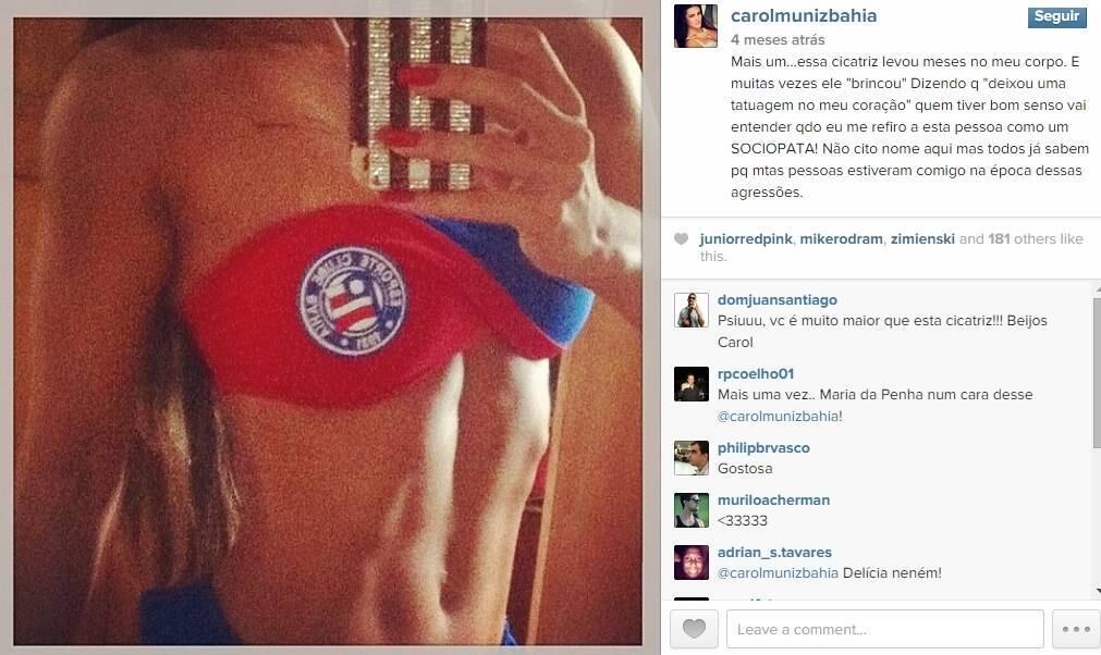 Em um post de junho no Instagram, Carol Muniz revelou que foi alvo de agressão de um ex-namorado.

— Mais um...essa cicatriz levou meses no meu corpo. E muitas vezes ele "brincou" Dizendo q "deixou uma tatuagem no meu coração" quem tiver bom senso vai entender qdo eu me refiro a esta pessoa como um SOCIOPATA! Não cito nome aqui mas todos já sabem pq mtas pessoas estiveram comigo na época dessas agressões
