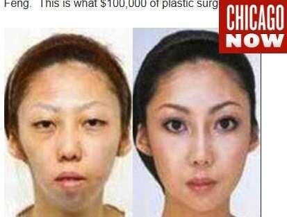 Foto mostra o antes e o depois das plásticas da ex-mulher de Feng