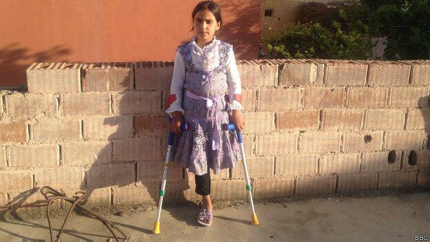 "Eu não vejo por que eu tinha que perder a minha perna só porque Bashar al-Assad queria permanecer no poder", diz Mariam (foto), de 9 anos.

Ela se lembra de todos os detalhes do dia no qual um avião de combate sírio veio em direção a sua casa, em um vilarejo na região de Homs. "Nós tínhamos uma grande janela. Eu olhei por ela e vi (o avião) vindo em nossa direção. Ele jogou o barril (com explosivos) e foi embora".

Até hoje, ela não consegue sentar em uma sala. E não consegue brincar com outras crianças em um parquinho no sul da Turquia