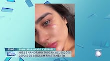 Miss e namorado trocam acusações de agressão após briga em São Paulo