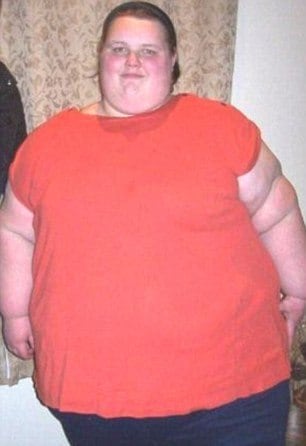 Georgia Davis, de 22 anos, de Aberdare, sudoeste do País de Gales, chegou a ser considerada a adolescente mais gorda do Reino Unido. Sempre teve problemas de obesidade. No ano passado, foi internada por já não conseguir mais andar. O que ela não sabia, no entanto, é que nessas tristes condições, conheceria o namorado, o faxineiro do hospital chamado Matthew Takel. No fim do tratamento, 127kg mais magra, ele a abandonou. "Georgia só tinha olhos para a dieta", disse um amigo dele 
