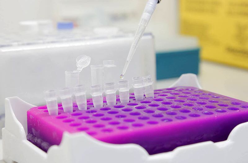 Teste para checar vírus zika é individual e usa reagente importado