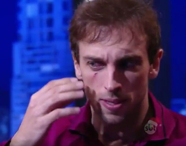 Léo Lins abriu um machucado embaixo do olho direito