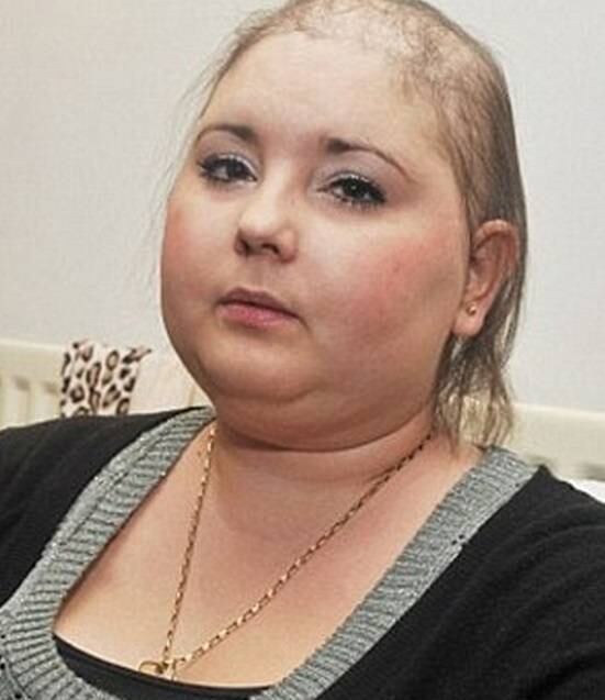 A jovem perdeu os cabelos após duas sessões de quimioterapia.
Ela também passou por um transplante de medula óssea. Depois disso, seu cabelo
voltou a crescer bem. Porém, a doença ressurgiu em 2010, e Samantha passou
novamente por quimioterapia.
— Minha filha Madison adora os meus cabelos agora. A primeira
coisa que ela fez quando me viu foi fazer uma trança