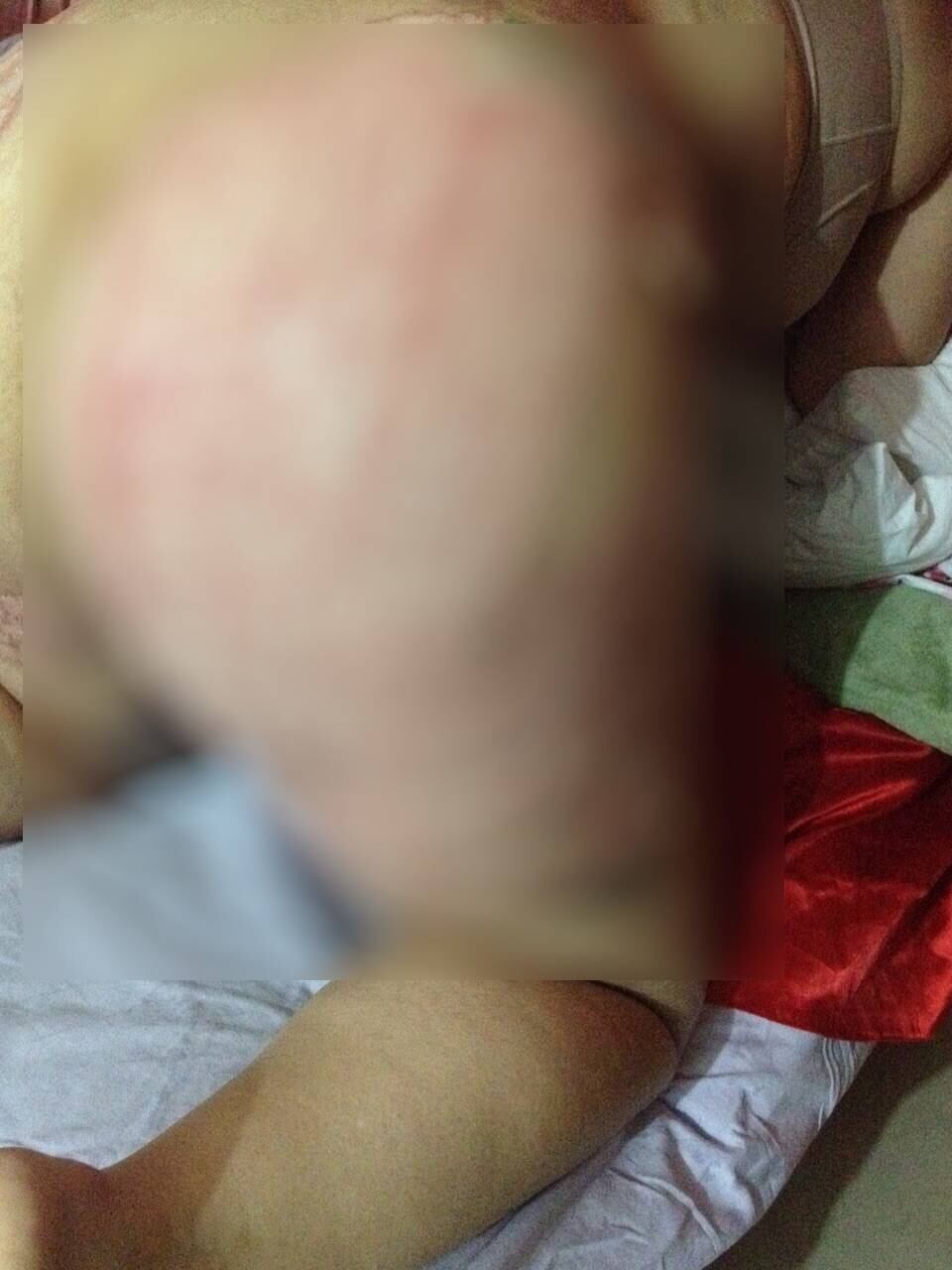 Avighi afirma que a irmã era uma mulher independente financeiramente. Se contar com a ajuda da família, ela conseguiu pagar os três procedimentos, com valor aproximado de R$ 16 mil. Primeiramente, Daniela pagou antecipado R$ 10.800. O restante foi divido em quatro cheques de R$ 1.094, que serão descontados a partir de agosto