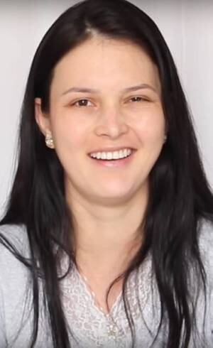 Julia Doorman sofreu paralisia de Bell uma semana após o nascimento da filha