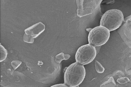 Em julho de 2014, duas
pessoas morreram e outras 11 adoeceram na Flórida após contraírem vibrio vulnificus, uma perigosa bactéria que vive na
água do mar e devora a carne humana, de acordo com informações do departamento de
saúde do Estado da Flórida, nos Estados Unidos. Entenda como a bactéria afeta o corpo humano
