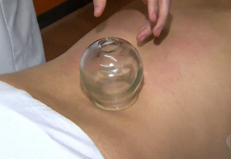 Algumas pessoas também recorrem à medicina chinesa. A ventosaterapia pode ser feita através das ventosas de vidro. O terapeuta usa fogo para queimar o oxigênio dentro delas e criar um vácuo nas costas