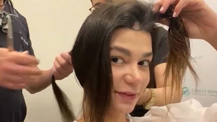 A atriz e professora de Yoga Pamela Otero também optou por fazer a cirurgia e corrigir uma falha que havia na frente do couro cabeludo