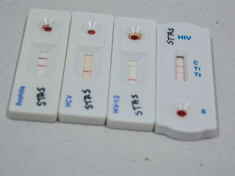 Dados do CFM mostram que, no Brasil, cerca de 25% dos casos de HIV são diagnosticados