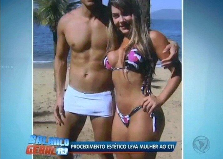 Na busca pela beleza, a jovem Vânia Prisco, de 29 anos, também está
sofrendo as consequências de aplicar um produto não recomendado pelos
médicos para aumentar o bumbum. Após injetar acrílico (substância
chamada de PMMA ou metacril), ela teve reações alérgicas e passou por
quase 40 cirurgias


