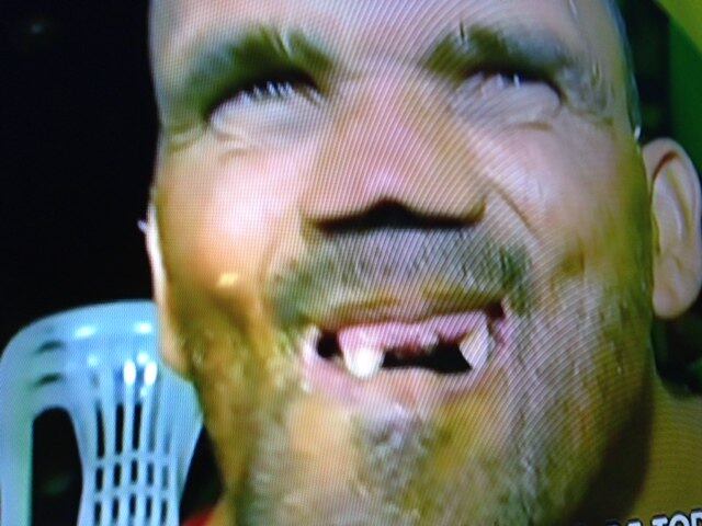 O mineiro Vanderlei Mendes, de 38 anos, foi eleito o homem mais feio do Brasil em 2013. Depois de ganhar o concurso, "Caveirinha" até conquistou uma namorada