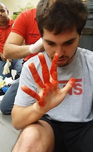 Jovem afirma ter levado coronhadas na cabeça